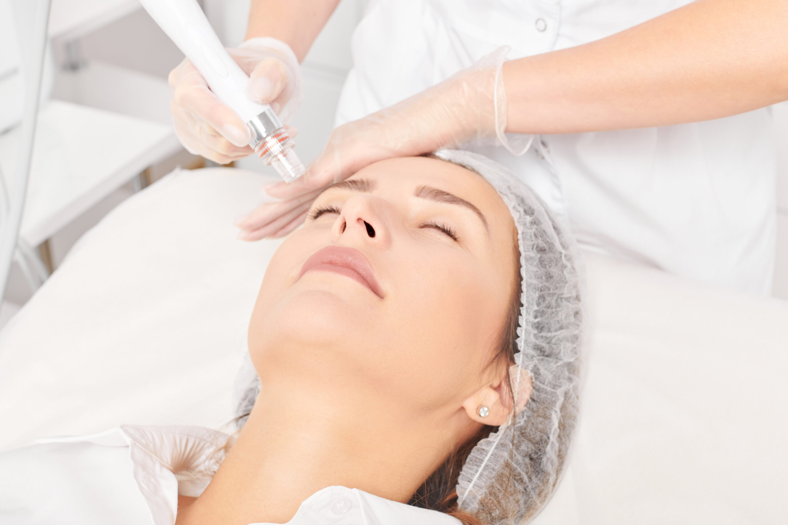Soin facial micro dermabrasion Mont-Tremblant