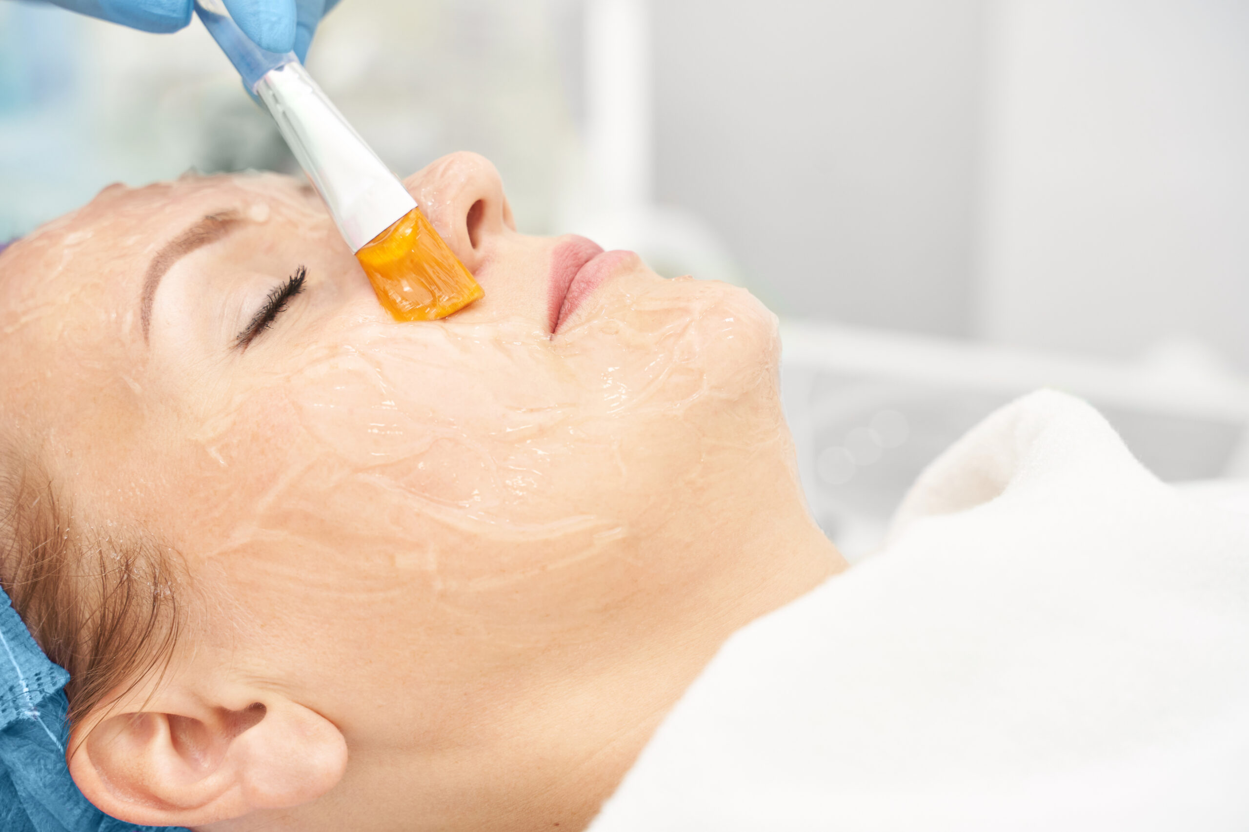 cure peeling Myriade
